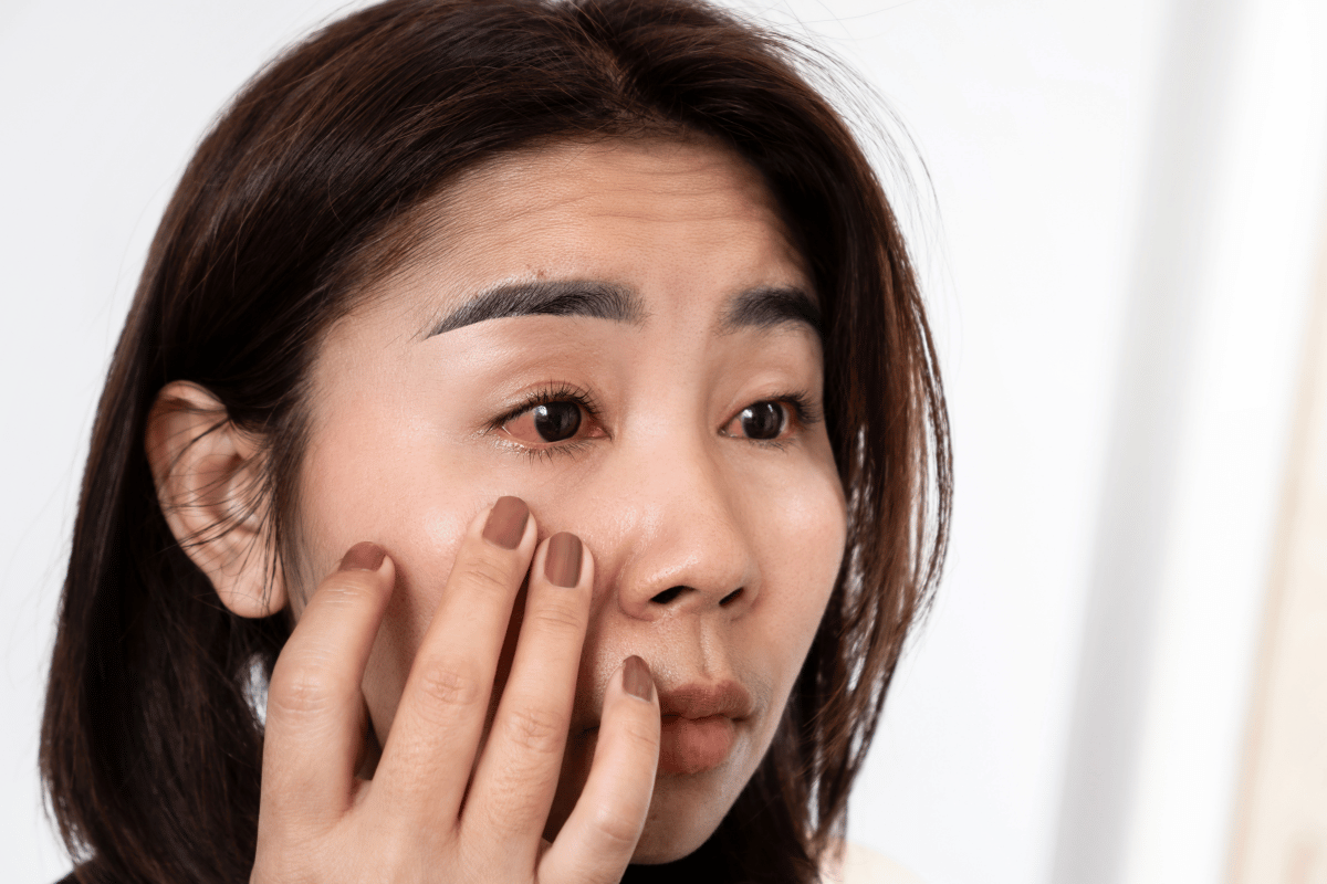 a woman suffering from eye inflammation and eye redness